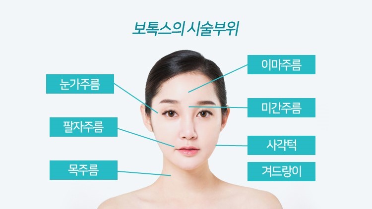 보톡스 부위