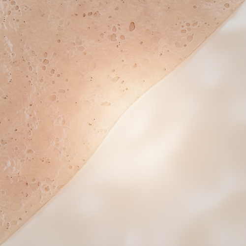 좁쌀 여드름? 색소 침착? 아젤리아 크림이 해결해 줄게요!