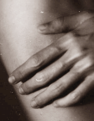 류마티스 관절염 초기증상