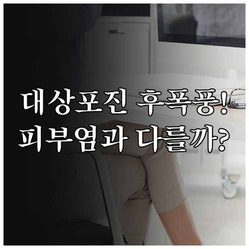 대상포진 후 신경통 예방과 피부염 증..