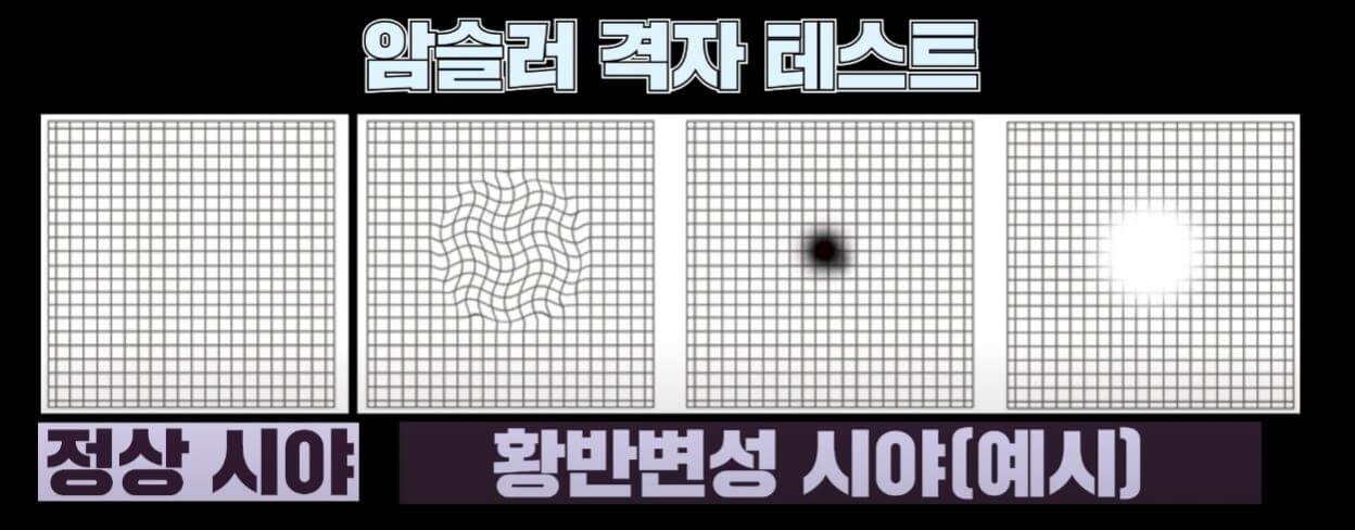 암슬러 격자 테스트