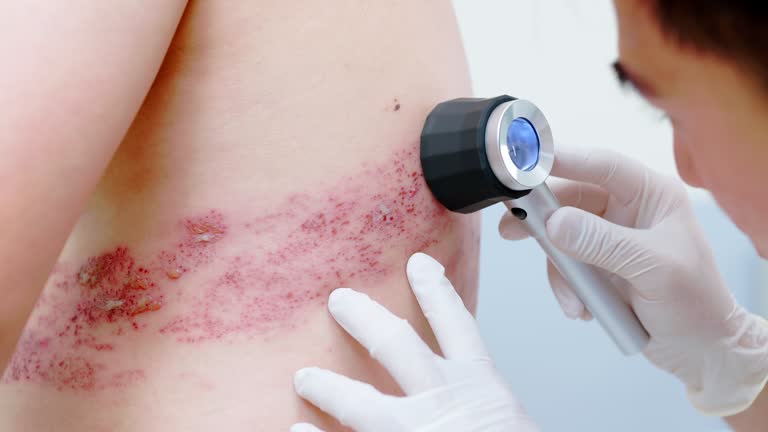 대상포진 증상과 치료, 평촌에서 믿을 수 있는 병원 찾기?