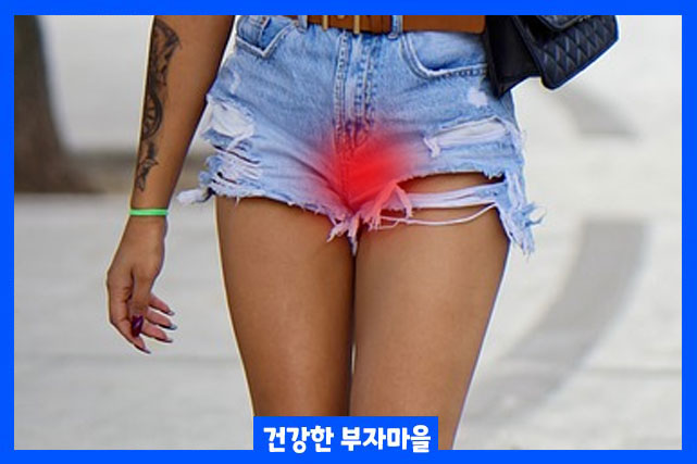 Y존 통증 원인 - 탈장