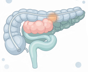 왼쪽 옆구리 통증