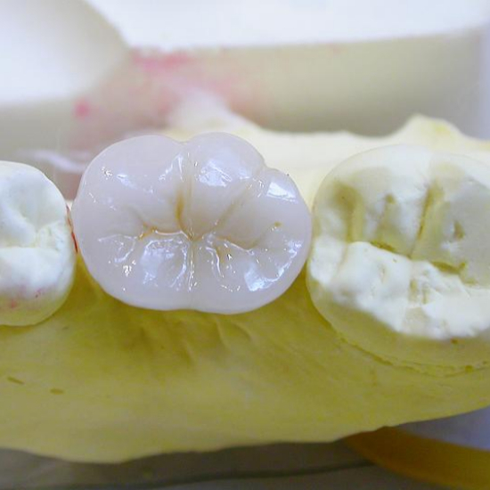 임플란트 성공률과 유지 관리의 중요성3