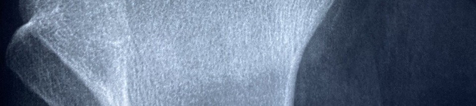 콘드로이친 효능 이미지