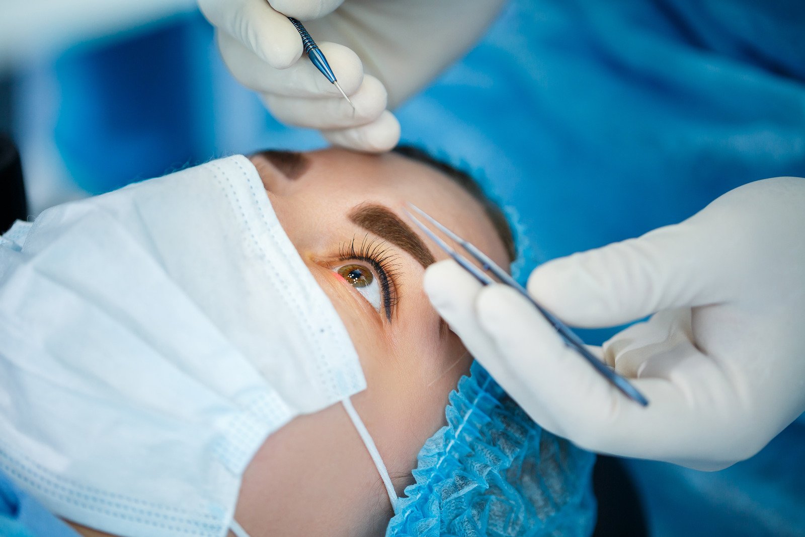 방수유출장치 삽입술(Aqueous Shunt Implantation): 녹내장 수술