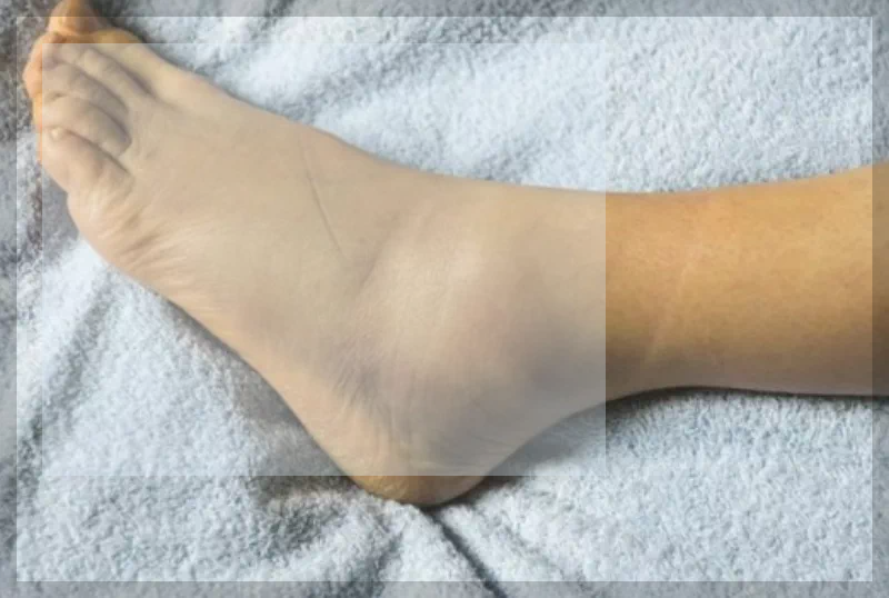 발바닥이 부었어요