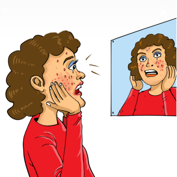 모낭염 관련 사진