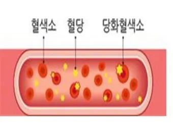 당화혈색소 정상치_2