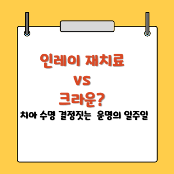 인레이치료 대 크라운 결정