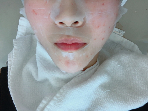 물광주사