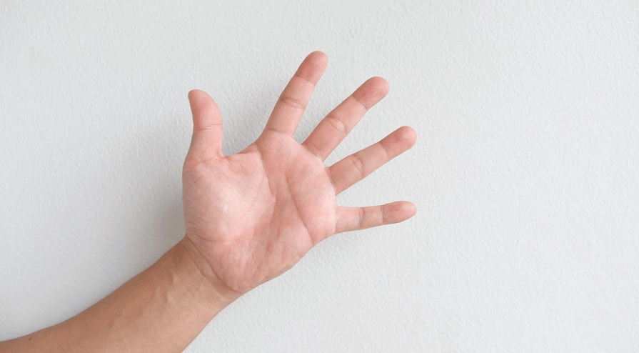 손바닥 껍질이 벗겨지는 이유를 알고 관리한 깨끗한 손바닥을 보여주고 있다