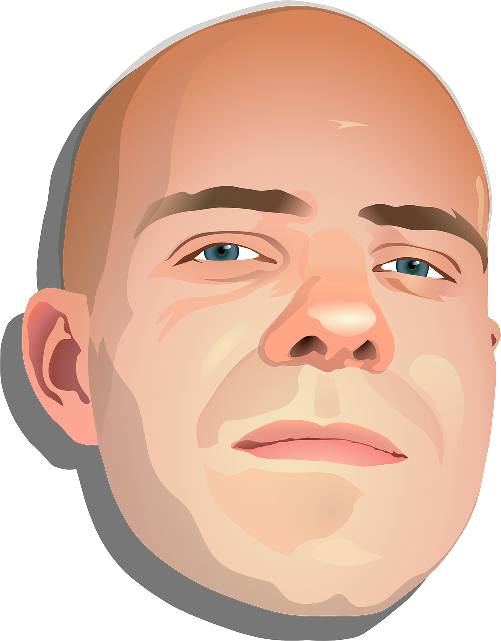 남성 탈모의 유형과 원인 그리고 전문가 조언과 판토가 캅셀 치료