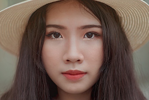 여드름이 나는 이유는?