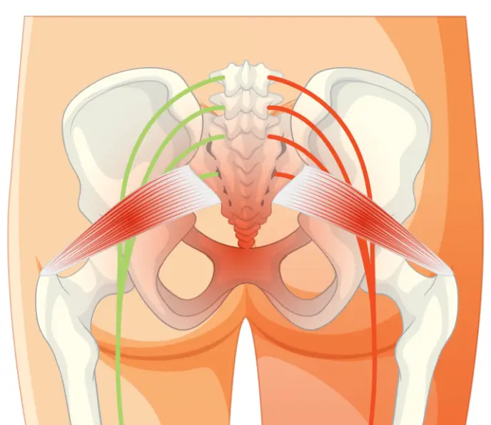 이상근-골반-일러스트