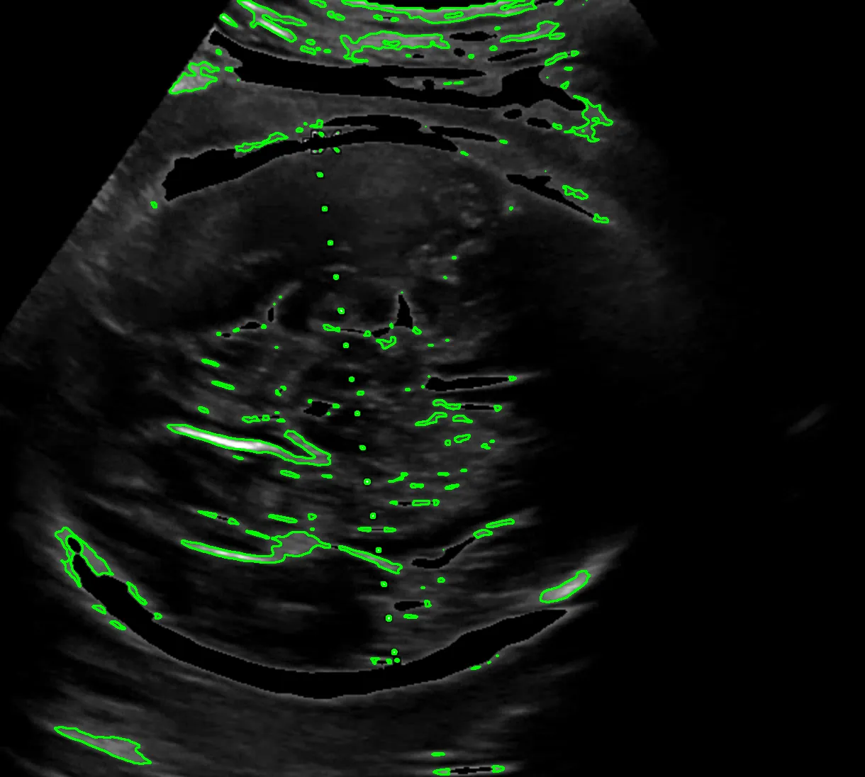 잘못 인식된 영역