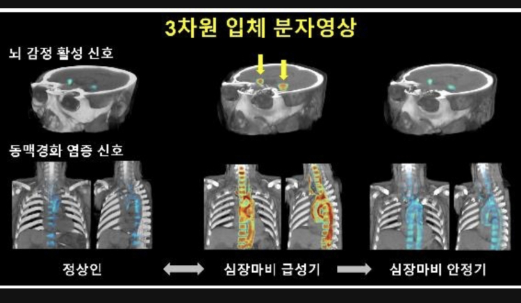 심장영상