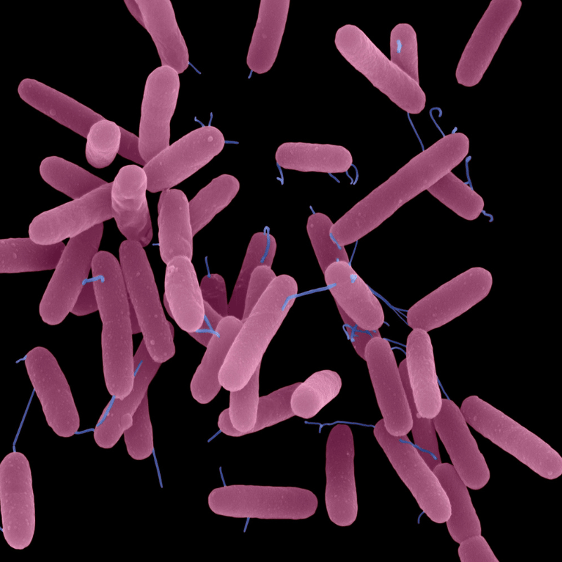 장염증상 먹어도되는 음식