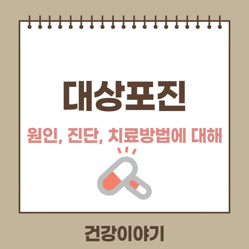 대상포진 원인, 진단, 치료에 대해