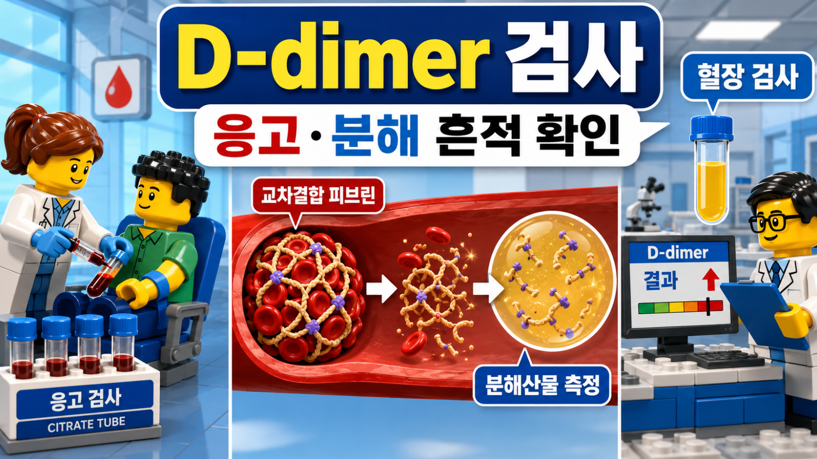 D-dimer 검사의 원리와 피브린 분해 과정, 혈장 검사를 설명하는 레고 스타일 의료 인포그래픽