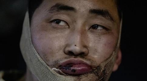 북한군 포로 한국행, 젤렌스키 발표로 알려진 송환 배경 정리 참고 이미지 2