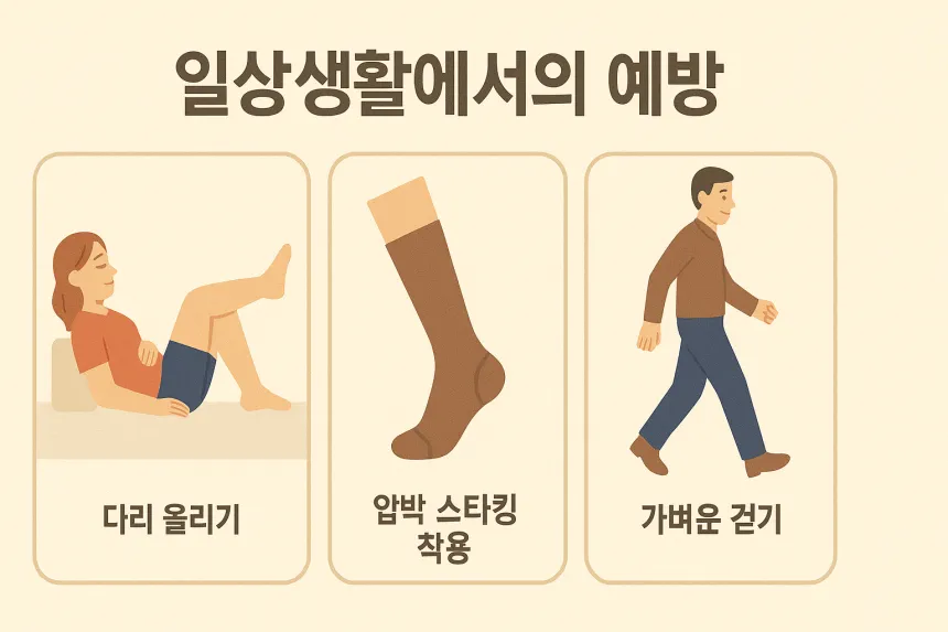 하지 정맥류 증상