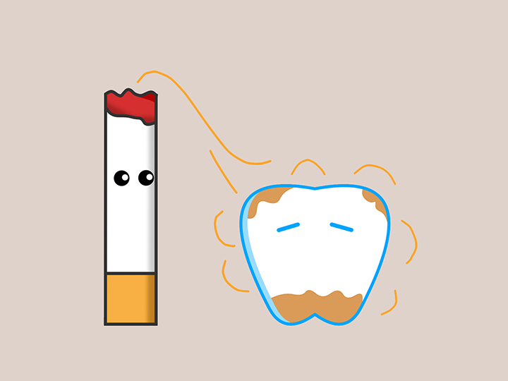 흡연으로-염증이-발생한-치아