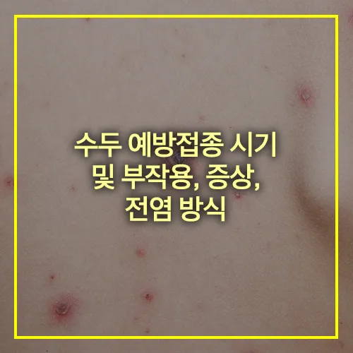 수두 예방접종 시기 부작용 증상 전염방식
