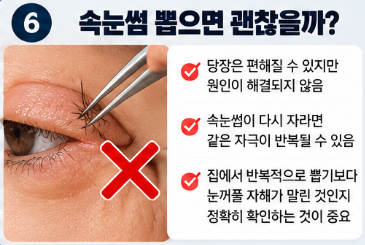 속눈썹 뽑으면 괜찮을까