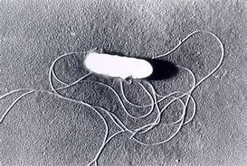 리스테리아 모노사이토제네스(Listeria monocytogenes)