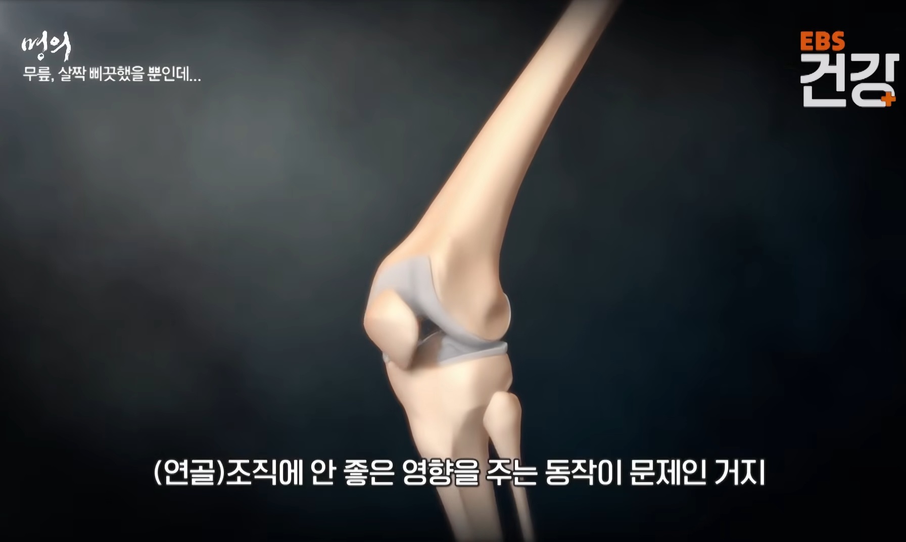 퇴행성-관절염-김성환-교수