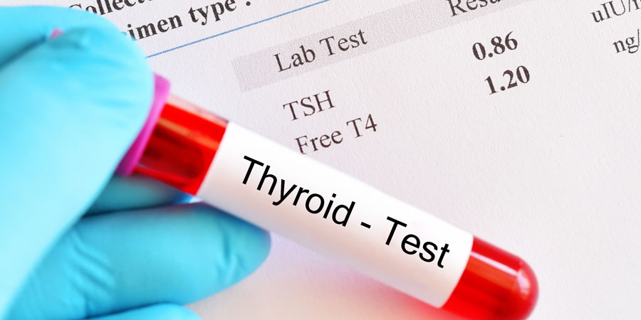 조기발견이-중요하다