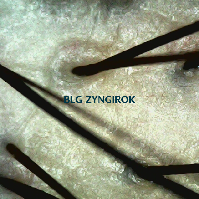 피나모아 29주차 - 정수리 두피 모습이다.