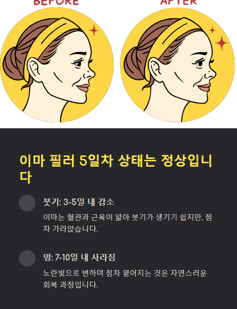 이마 필러 5일차 상태는 정상입니다