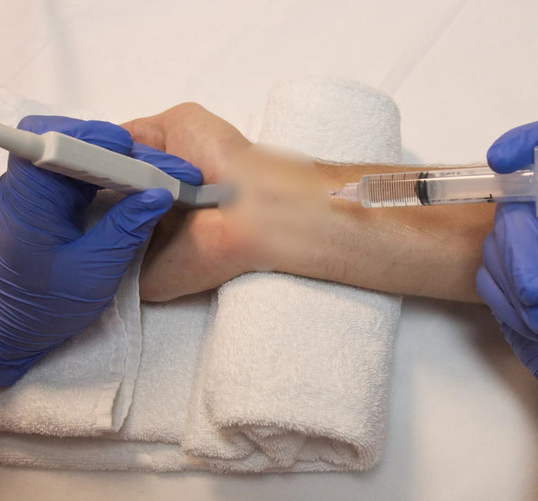 손목터널증후군 증상과 치료법 수술