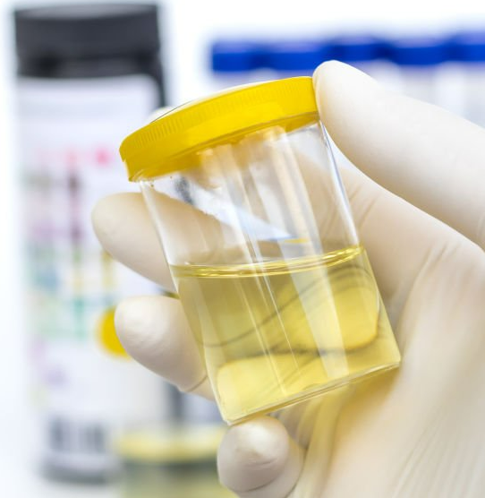 요로법의 원리, 방법, 유의점