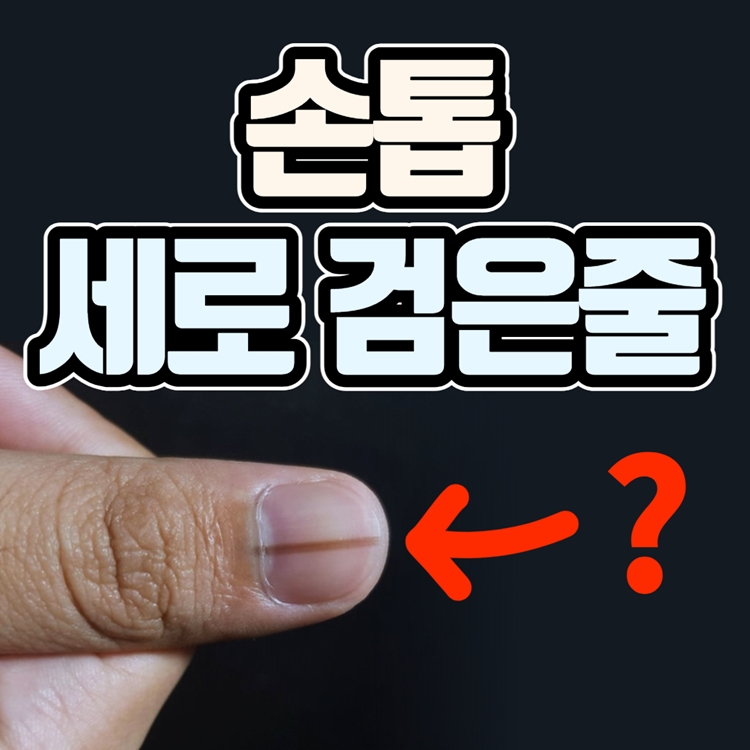 손톱 검은 세로줄