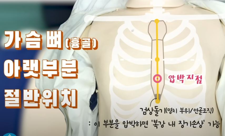 심폐소생술-가슴압박-위치