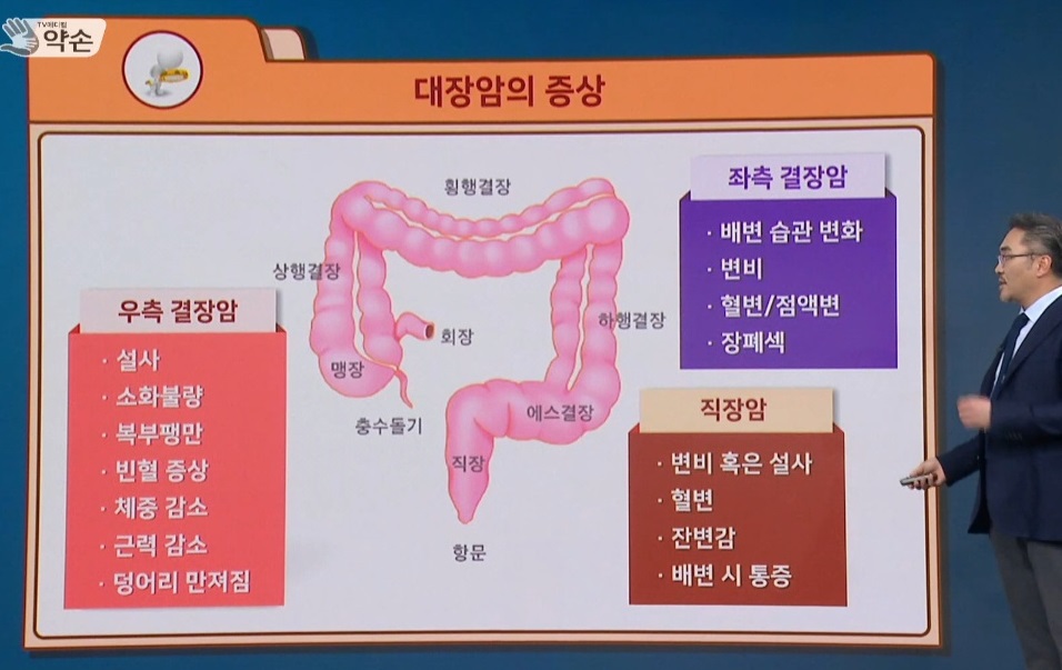 EBS명의-직장암-항문-명의-김진-교수-대장항문외과