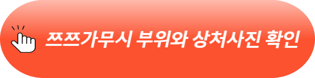 쯔쯔가무시