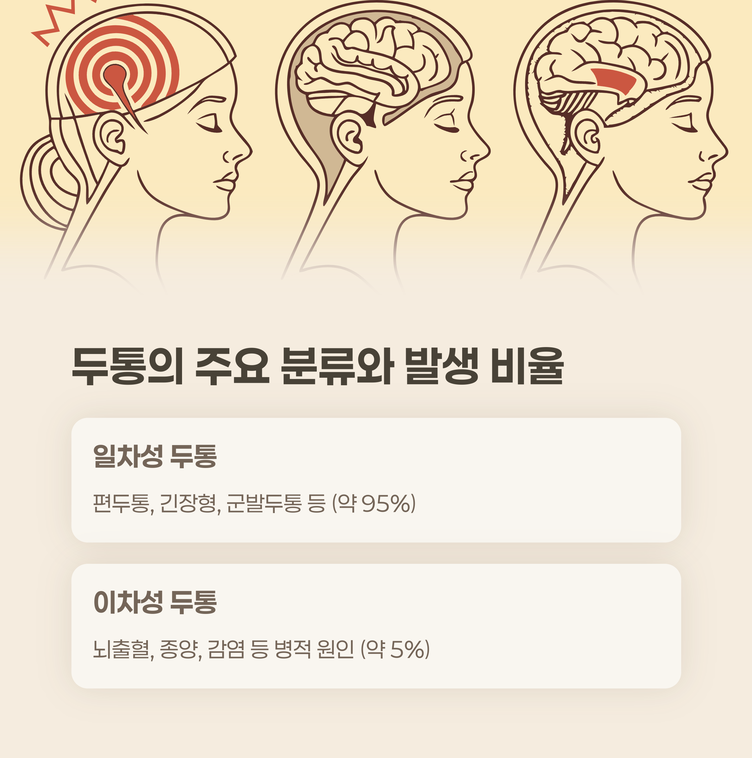 두통의 주요 분류와 발생 비율