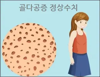 골다공증 정상수치