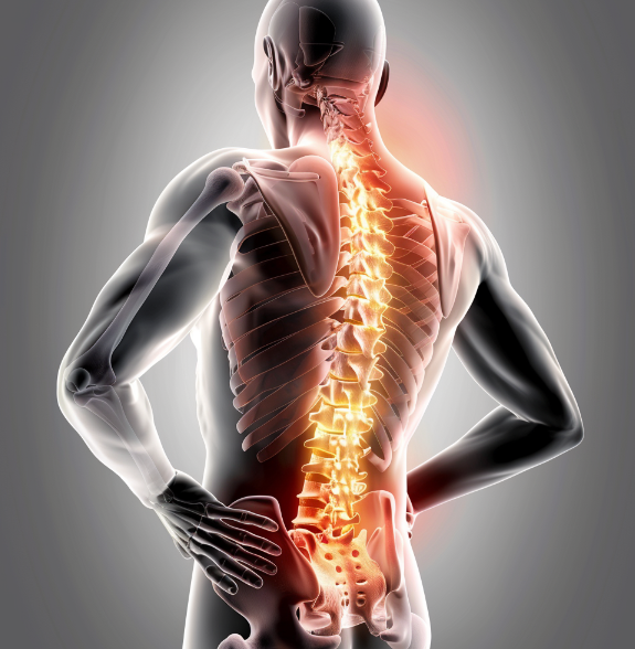 허리 삐끗했을 때 