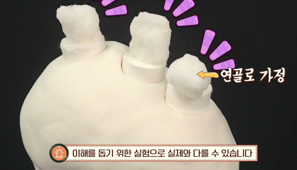 콘드로이친 효능