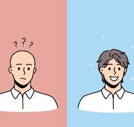 탈모 보조제란 무엇인가.