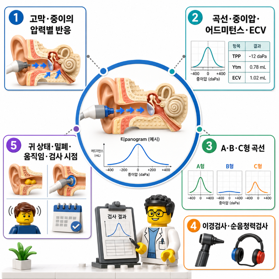고막운동성검사의 측정 대상, 결과 구성, A·B·C형 곡선, 관련 검사, 결과 영향 요인을 5가지 핵심으로 요약한 의료 인포그래픽