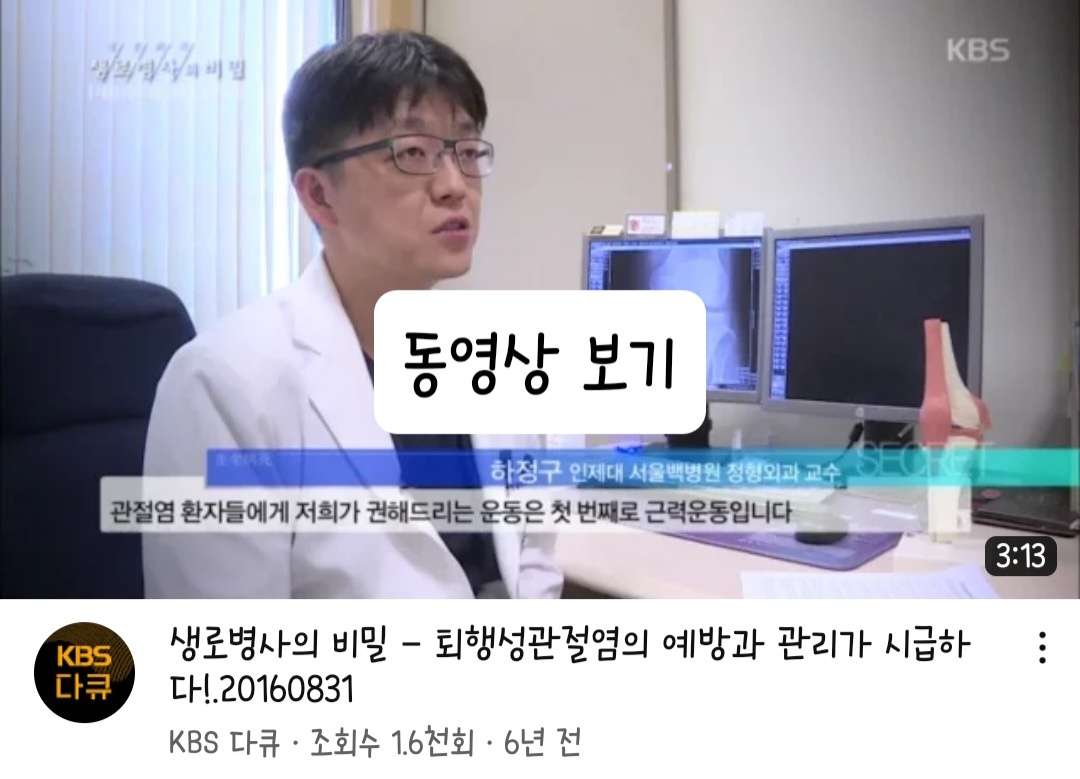 관절염 초기증상