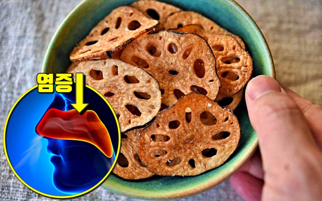 비염에 좋은 음식, 연근