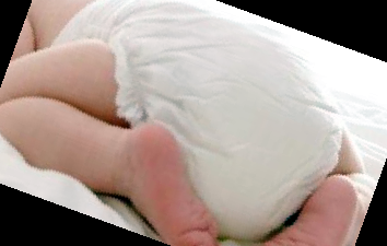 피똥사는 이유 대장암